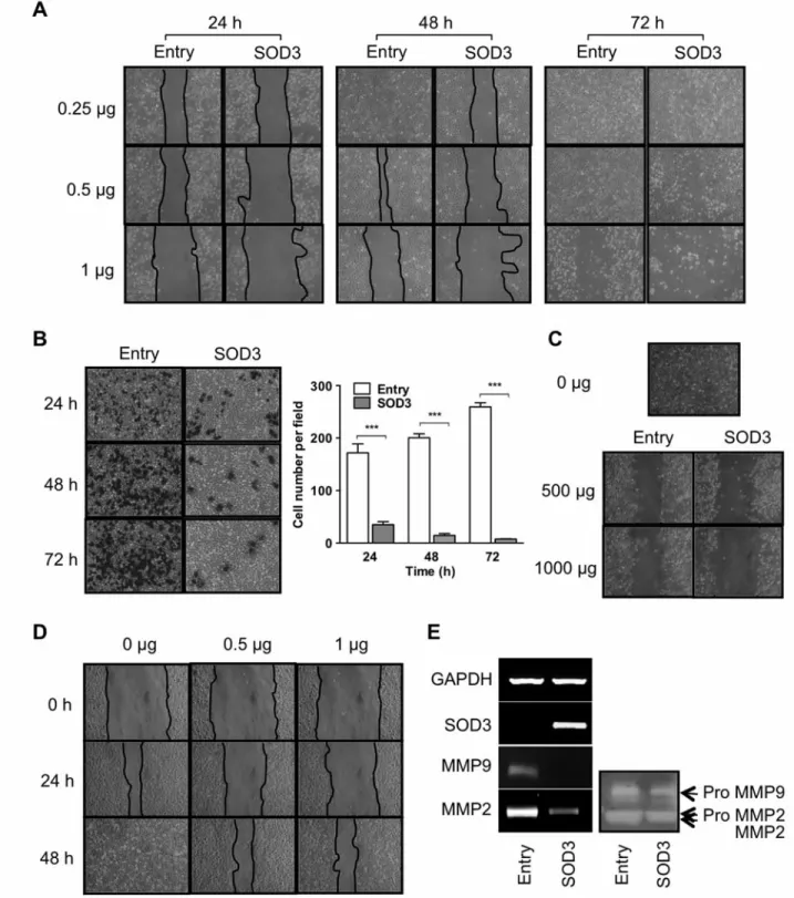 Figure 4. Effect of superoxide dismutase 3 on cell migration and invasion in PC-3 cells