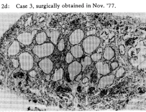 Fig.  2.  Histological  findings.