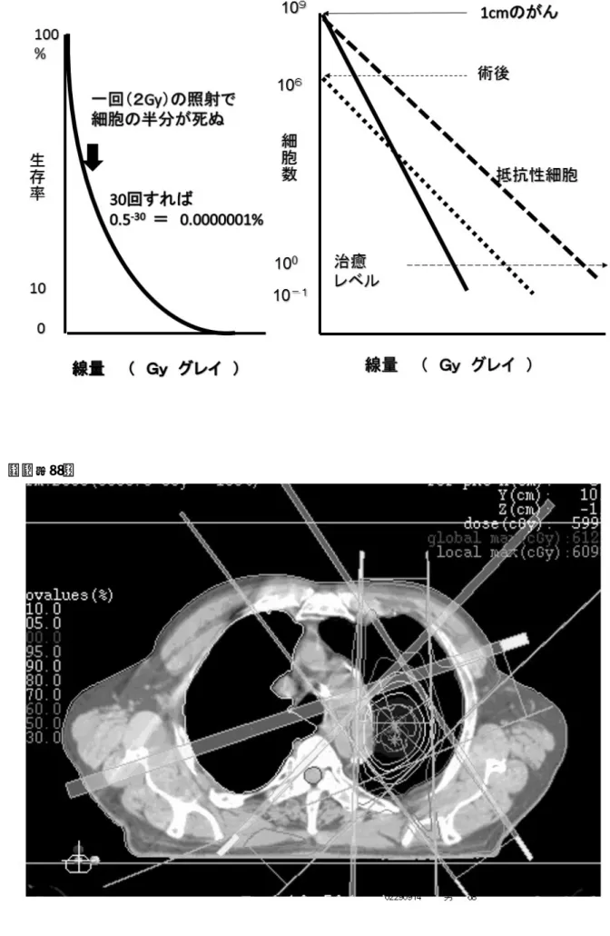 図 2  線量分布図 