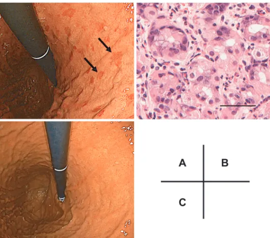 Fig. 3 Gastroscopic and pathological findings.