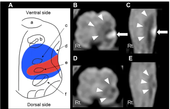 Fig. 5 Brain MRI on day 21.