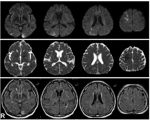 Fig. 2 Brain MRI on admission