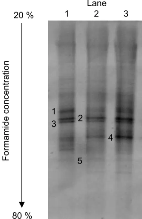 Fig. 4 DGGE profile of PCR products (Lane 1, DNA sample 1; Lane 2, DNA sample 2; 