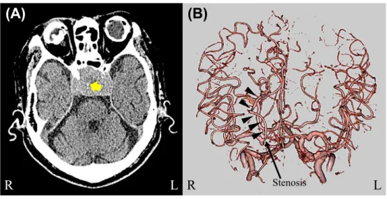 Fig. 1 Brain CT images on admission.