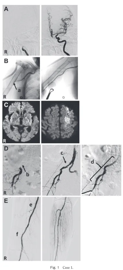 Fig. 1 Case 1.