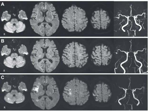 Fig. 1 Brain MR diffusion-weighted imaging (DWI) and angiography (MRA) on Days 0, 16, and 27.