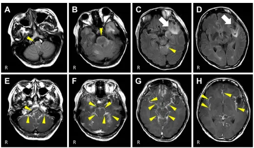 Fig. 3 MRI findings of the brain on the morning of day 6.