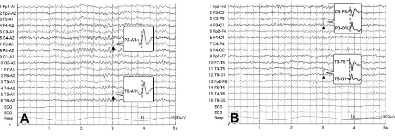 Fig. 2 MRI.