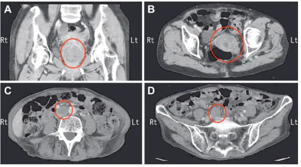 Fig. 1 Enhanced CT of abdomen and pelvis.