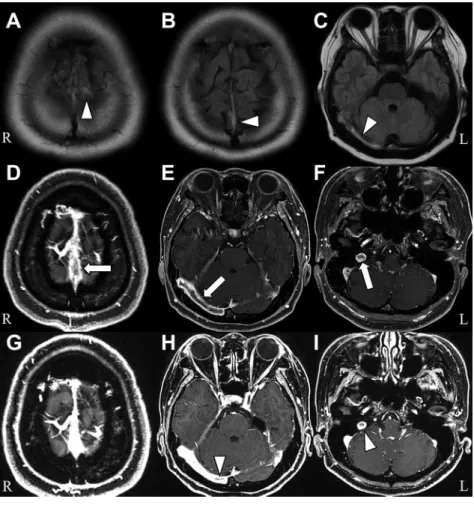 Fig. 1 Brain MRI findings.