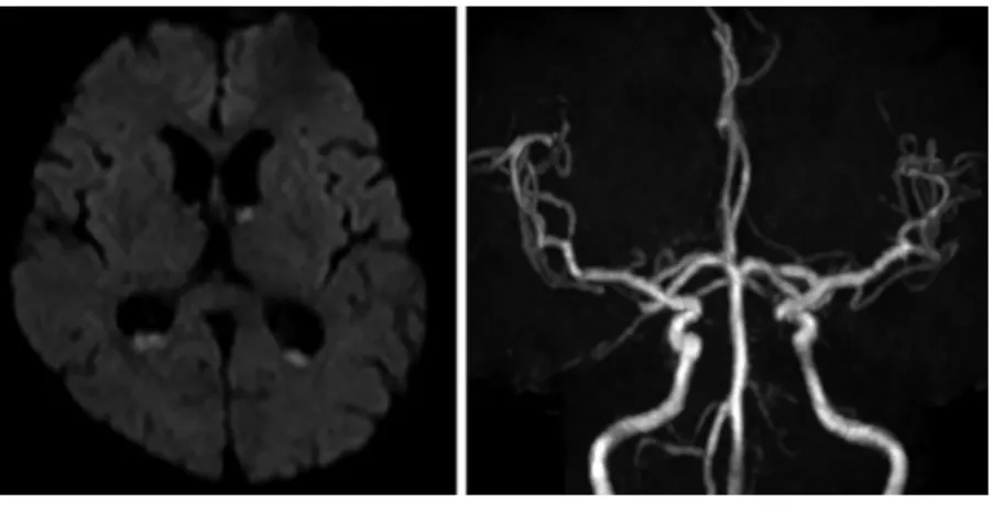 Fig. 1 Brain MRI on admission.