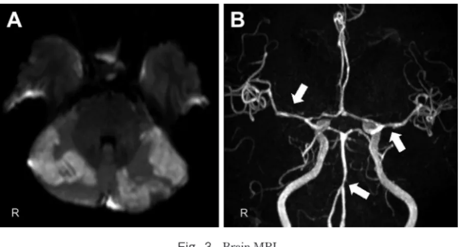 Fig. 4 Brain CT angiography (CTA).