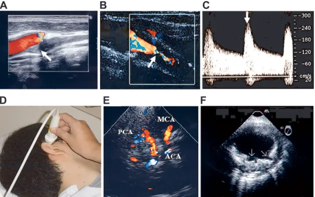 Fig. 1 Ultrasonographic evaluations for stroke patients.