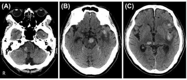 Fig. 2 Brain MRI on admission.
