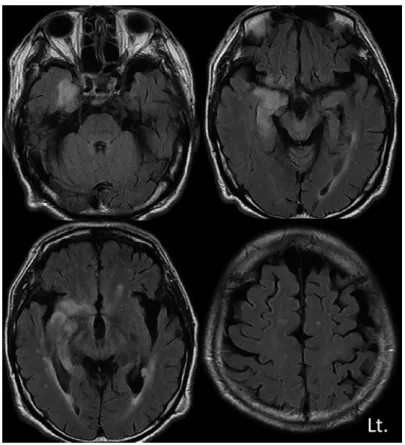 Fig. 3 Brain MRI FLAIR images.