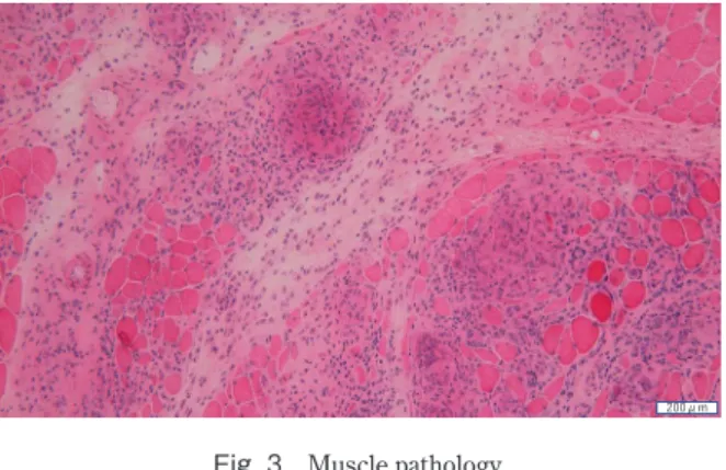 Table 1　Sarcoidosis diagnostic criteria.