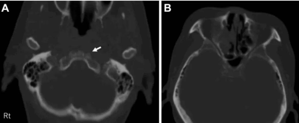 Fig. 2 Brain MRI at his first visit to our department.