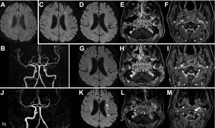 Fig. 3 At admission (A, B), first visit to our department (C–F), 2 weeks later (G–I), and at 6 weeks (J–M).