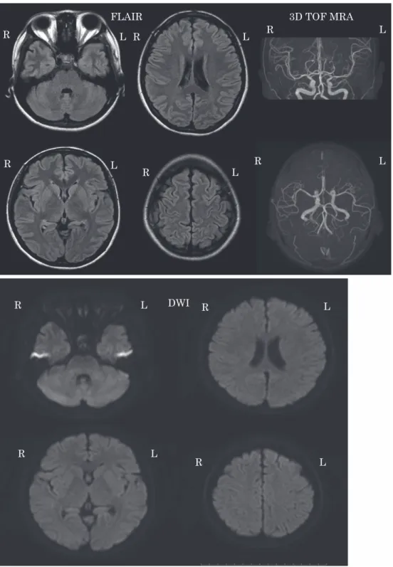 Fig. 1 MRI image (3 T) on day 11.