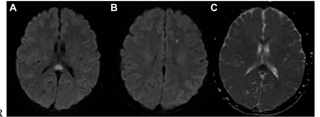 Fig. 2 Brain MRI on the 16th day of onset.