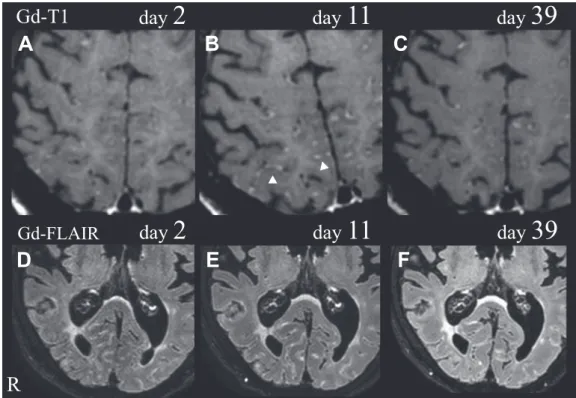 Fig. 2 Clinical course of treatment.