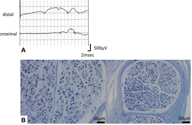 Table 1　Nerve conduction studies in this case.