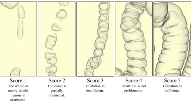 Fig. 1    Visual evaluation of colonic dilatation   
