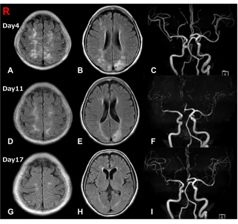 Fig. 2 Eye movement.