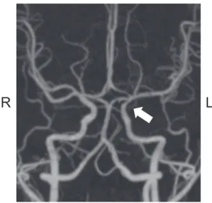 Fig. 2 Three-dimensional CT angiography (3D-CTA) on day 2.