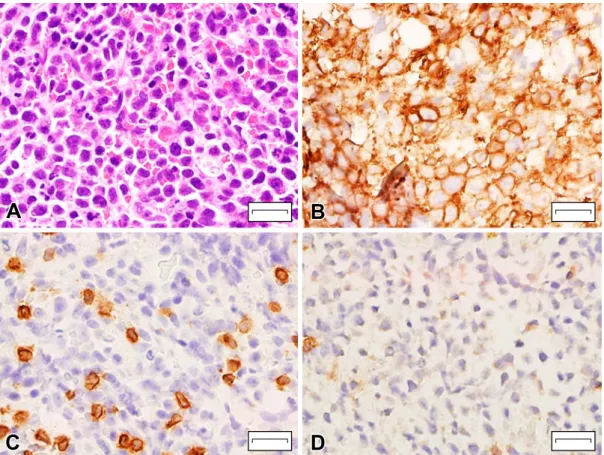 Fig. 4　Clinical course.