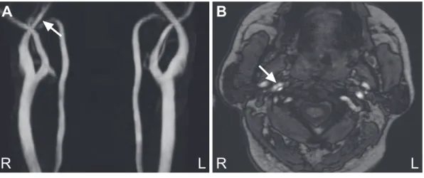 Fig. 3 Cervical MRI and MRA on day 2.