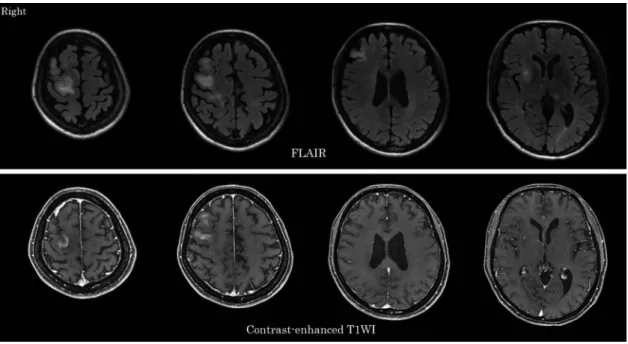 Fig. 2 18F-fluorodeoxyglucose positron emission tomography/