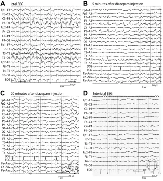 Fig. 3 Scalp EEG recordings.