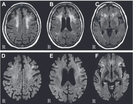 Fig. 2 MRI at second admission.