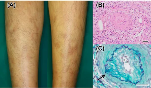 Fig. 1 Skin and skin biopsy findings.