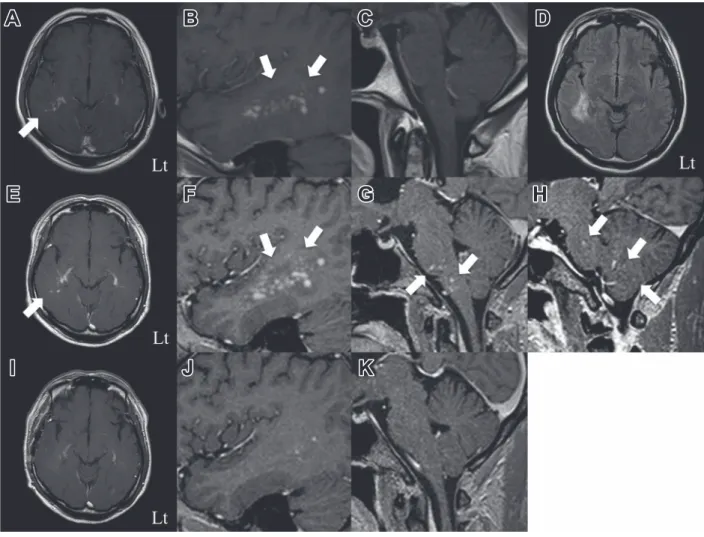 Fig. 1 Brain MRI findings.