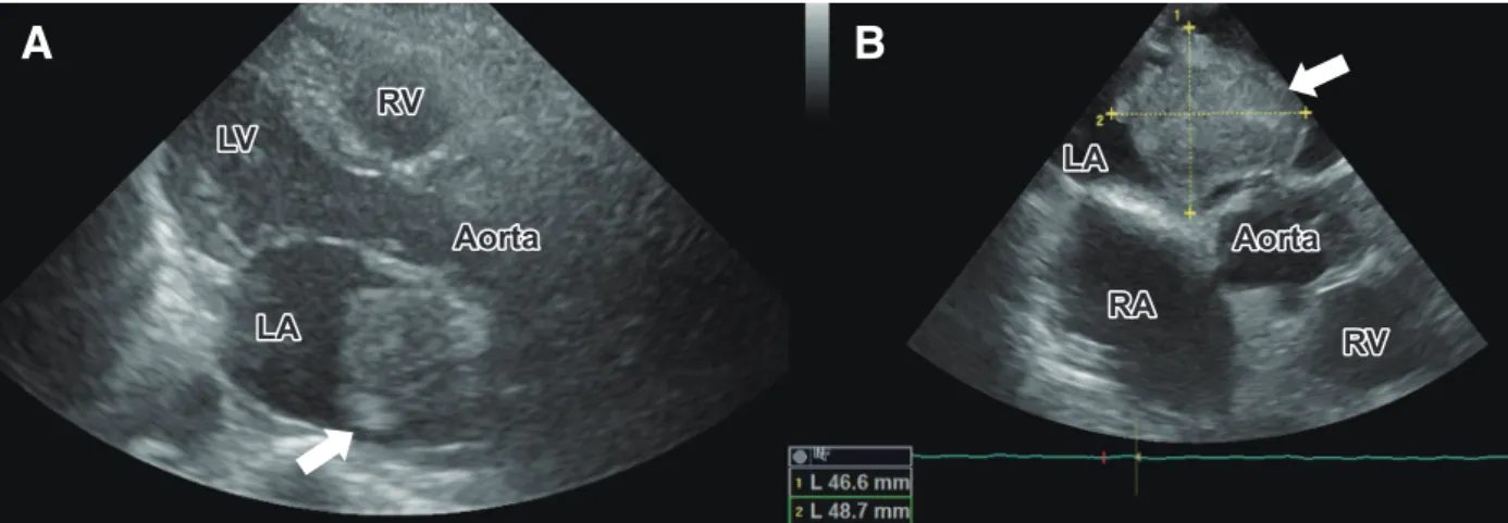 Fig. 5 Gradient-echo T 2 * weighted MRI on the secondary day in  hospital.