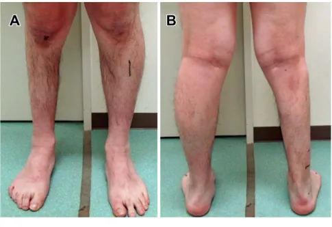 Fig. 1　Legs of Case 1.