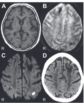 Fig. 2 Brain MRI findings during deep coma.
