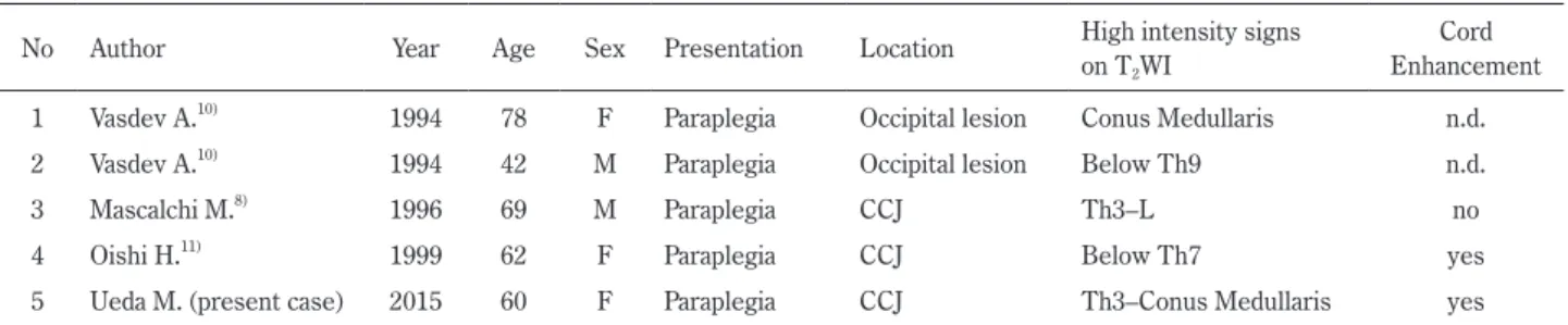 Table 1  Summary of cases of intracranial DAVF with thoracolumbar myelopathy.