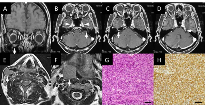 Fig. 1 Neuroimaging and pathological findings.