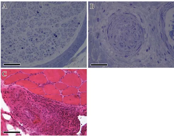 Fig. 2 Axial  18 F-FDG PET CT images.