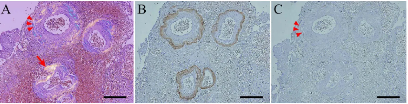 Fig. 4 Pathological findings (2).