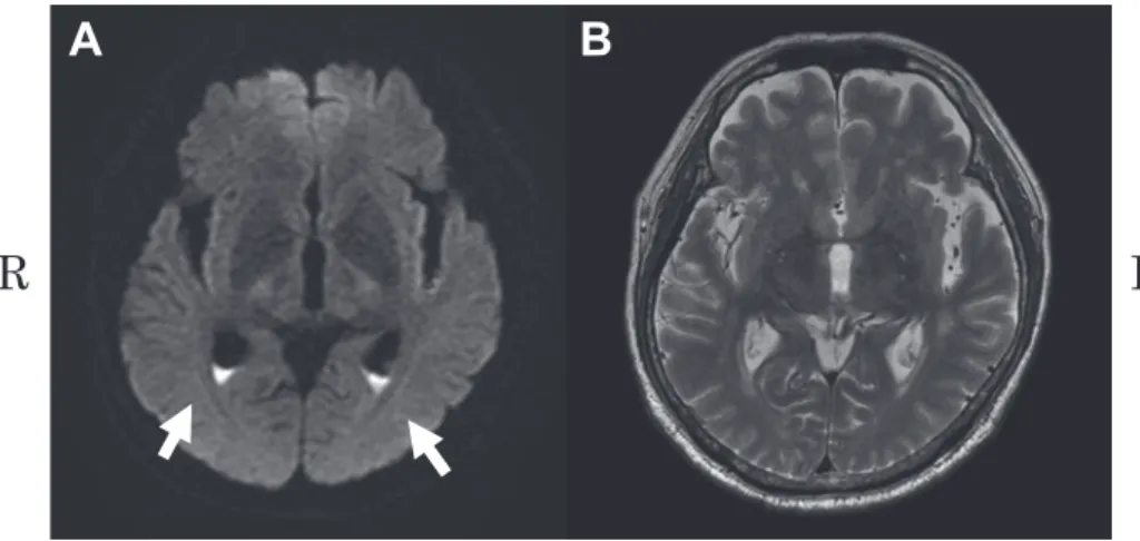 Fig. 1 Brain magnetic resonance imaging (MRI).