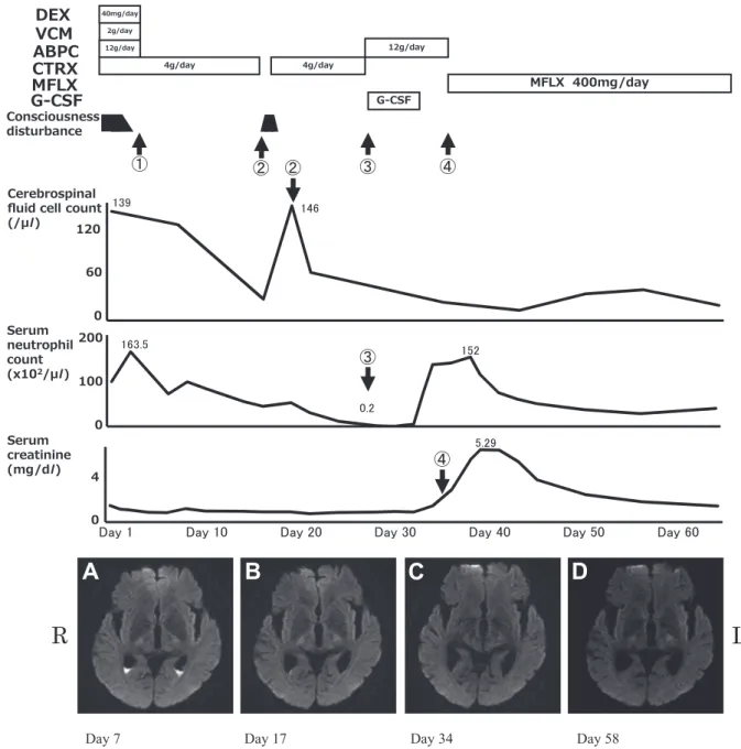 Fig. 2 Clinical course of our patient along with diffusion-weighted magnetic resonance imaging (DWI) (3 Tesla).