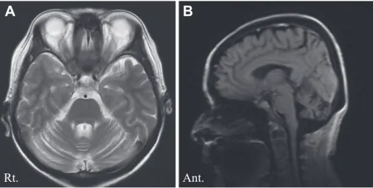 Fig. 2 Contrast-enhanced computed tomography.