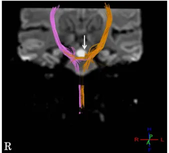 Fig. 1 Brain MRI (obtained on admission).