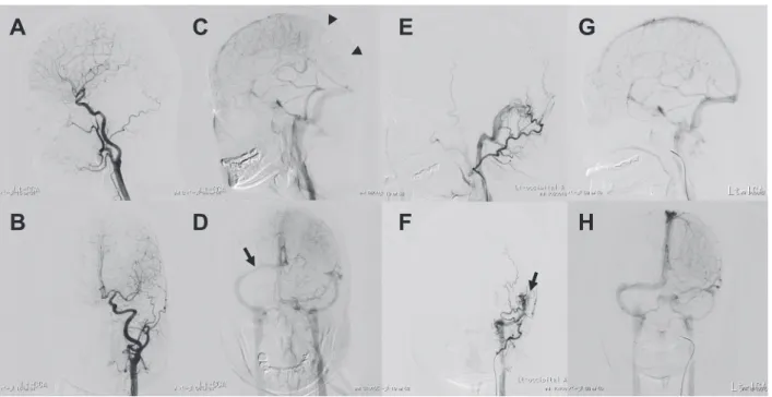 Fig. 2 Digital subtraction angiography.