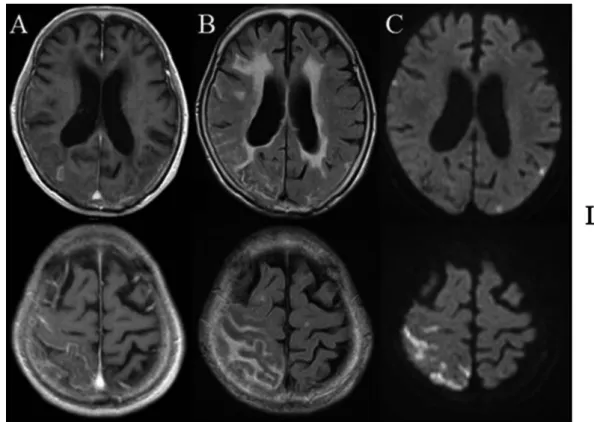 Fig. 1 Brain computed tomography on admission.