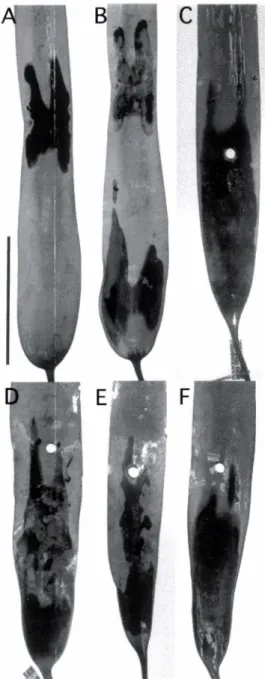 Fig.  4.  Formation  of  zoosporangial  sorus  on  the  sporo- sporo-phyte  of  Laminaria  japonica  at  various  temperatures 